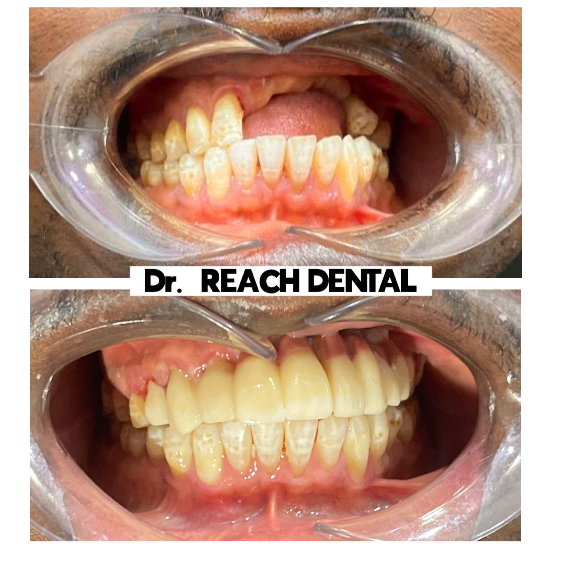 Reach Dental Orthodontics. Facebook ad