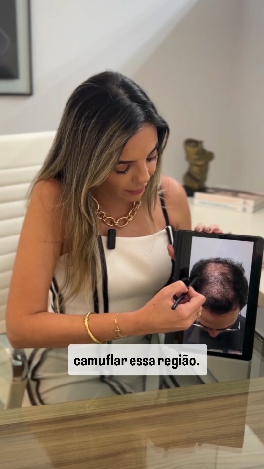 Laila Iunes Estética Avançada Facebook ad: Micropigmentação Capilar: efeito raspado ou camuflagem do…