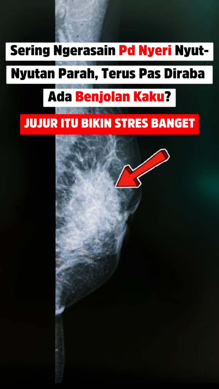 Distributor Zymuno Indonesia Facebook ad: Parno nemu benjolan kaku di area PD plus…