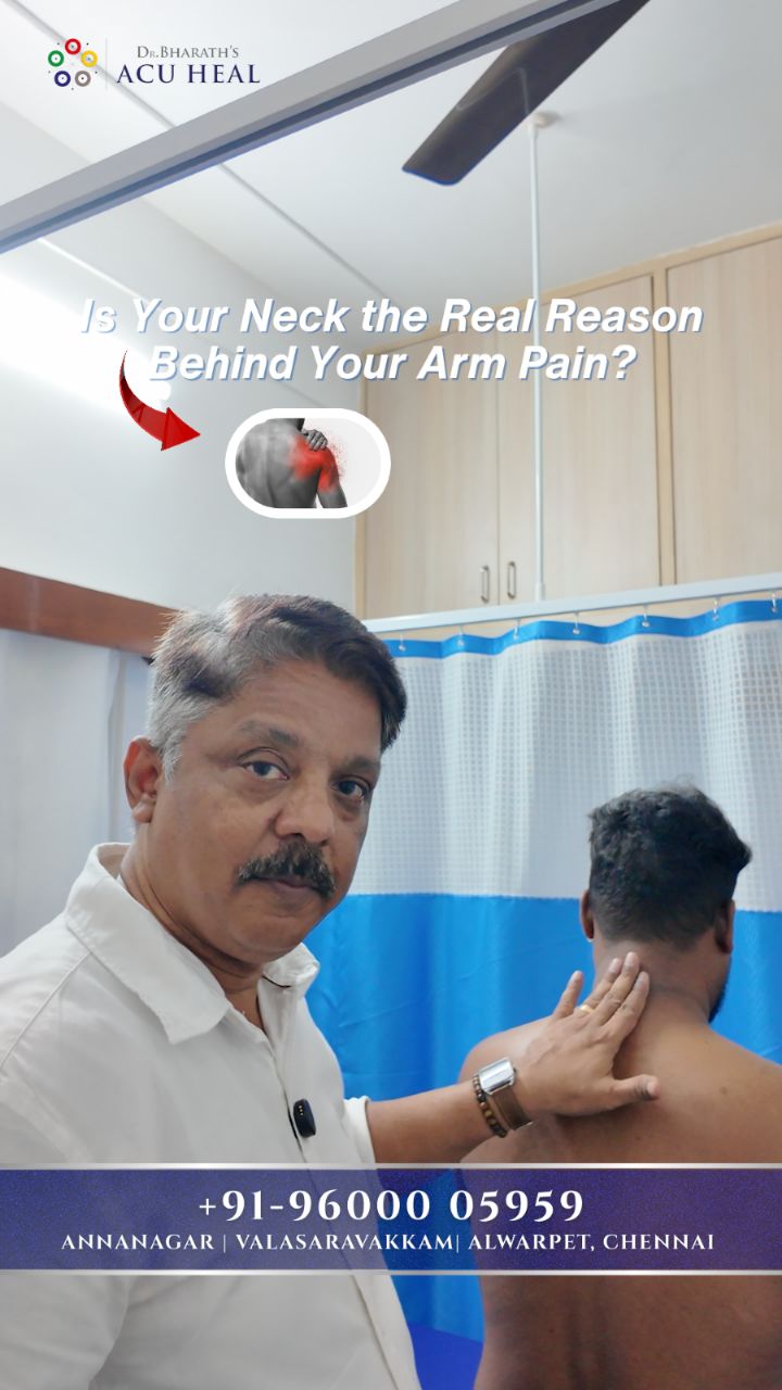 Dr. Bharath's Acu Heal Facebook ad: Is your arm pain actually starting from your…