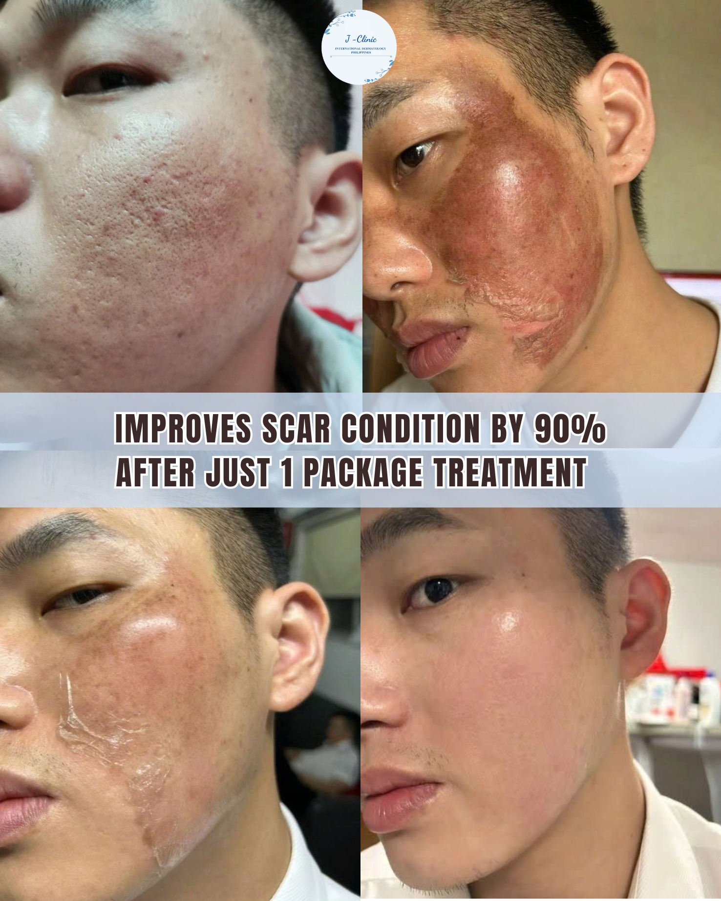 International Dermatology J Clinic Facebook ad: No time for downtime?