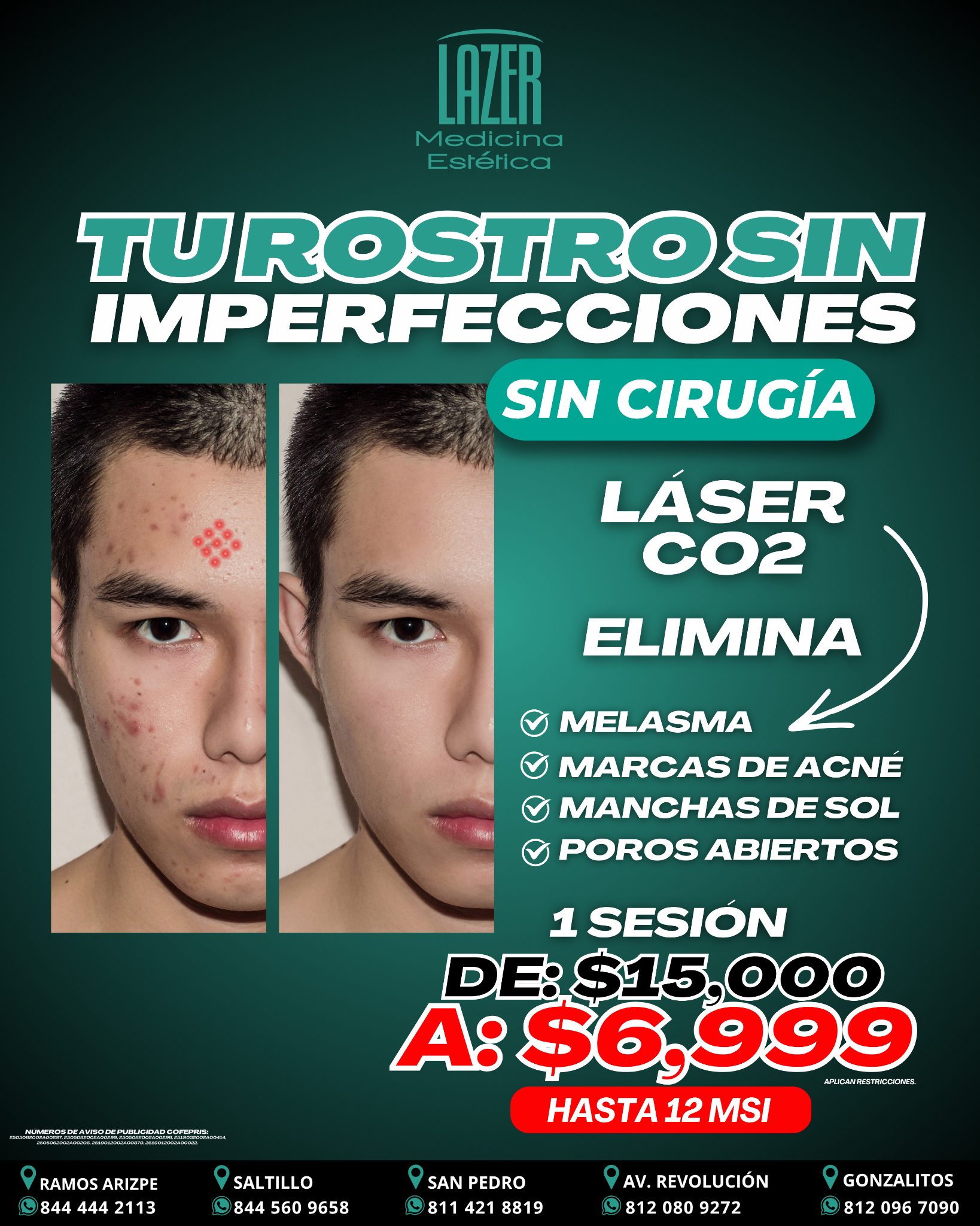 Lazer Medicina Estética MX Facebook ad