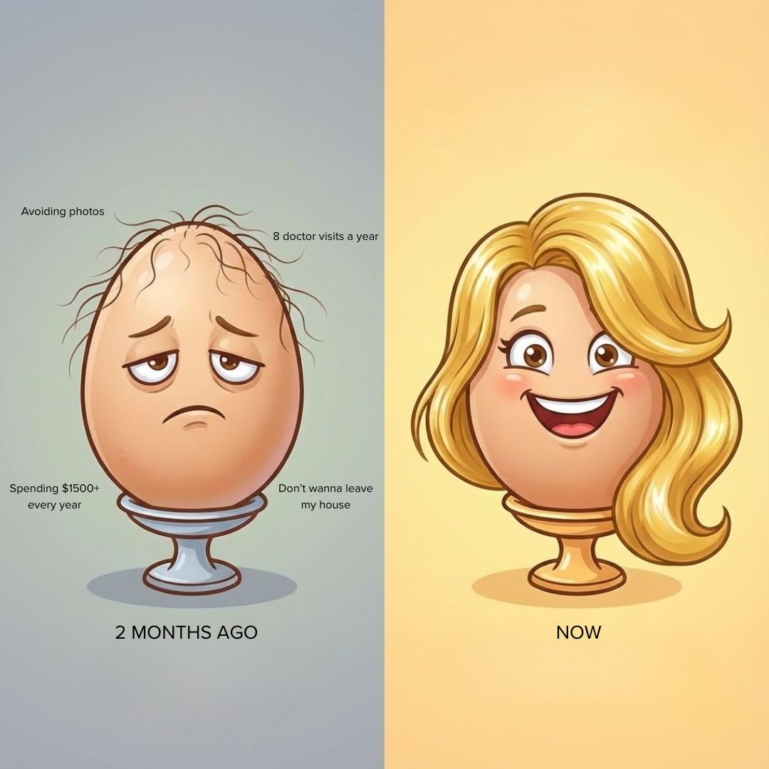 Personalized Hair Care Facebook ad: You’re Not Losing Your Hair, Your Scalp Is Starving