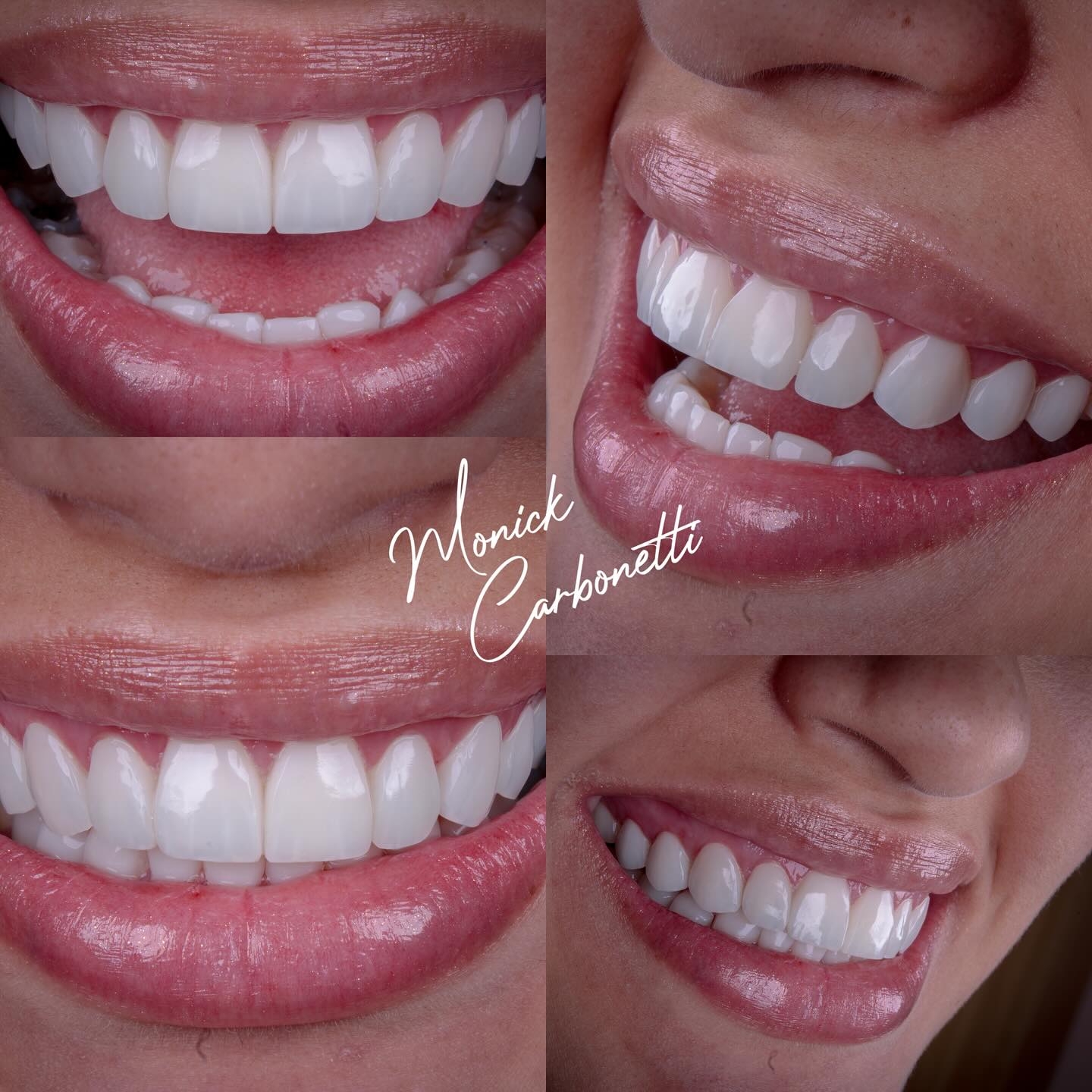 Dra Monick Carbonetti Facebook ad: Um sorriso bonito muda tudo, a expressão, a…
