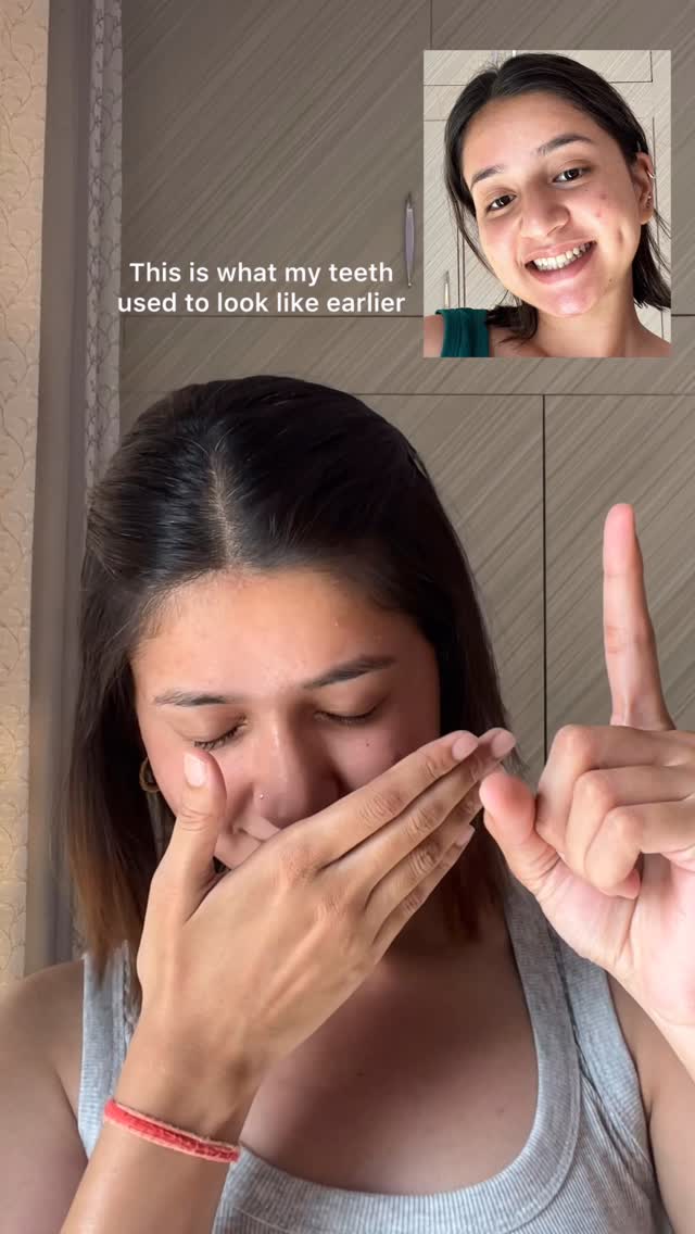 Smile by Fang Facebook ad: From hiding my smile to flexing it 10…