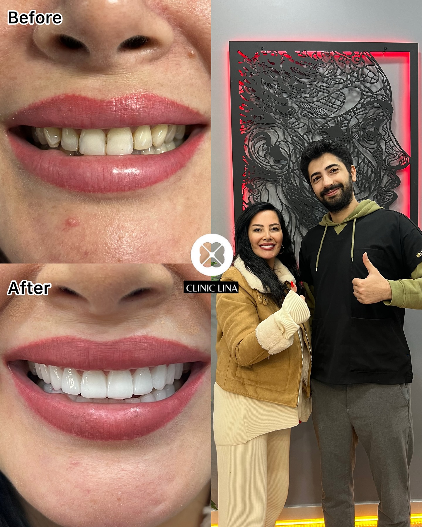 Clinic lina Facebook ad