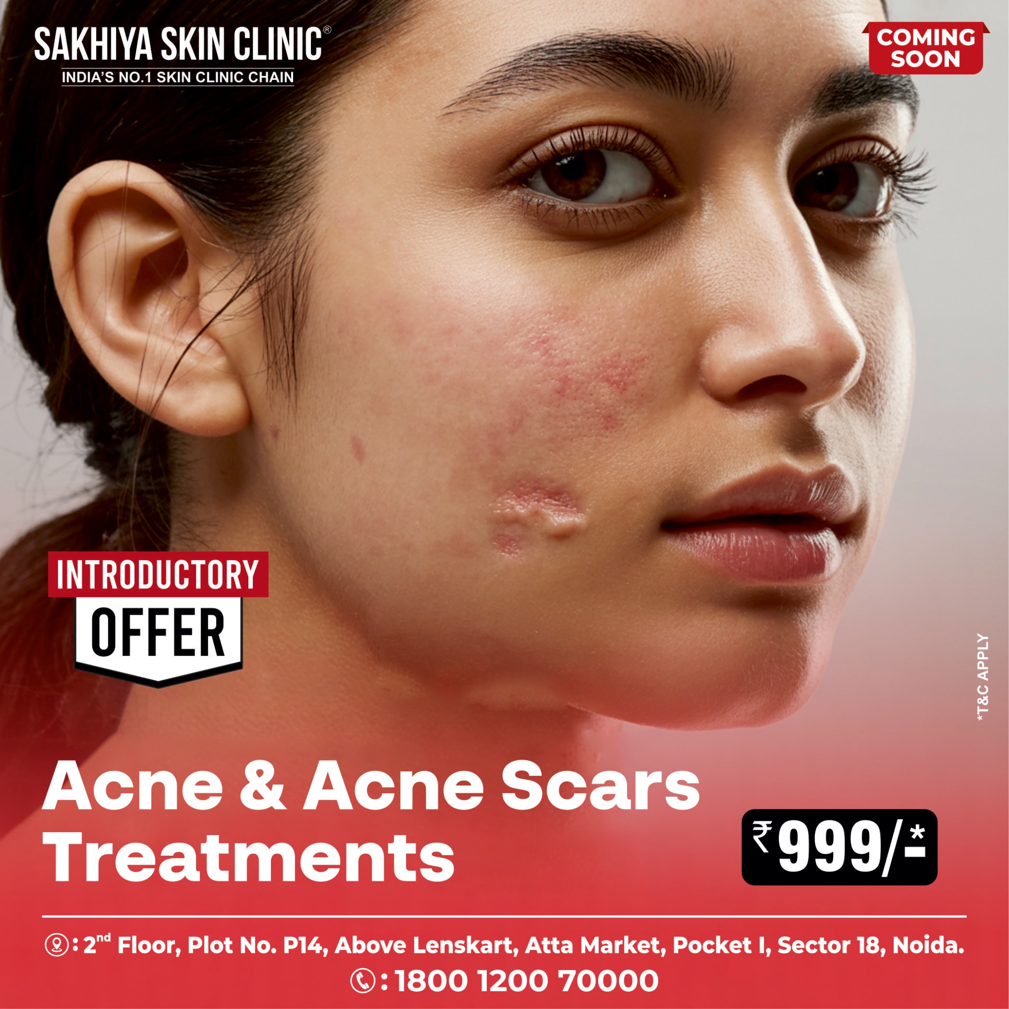 Sakhiya Skin Clinic Facebook ad