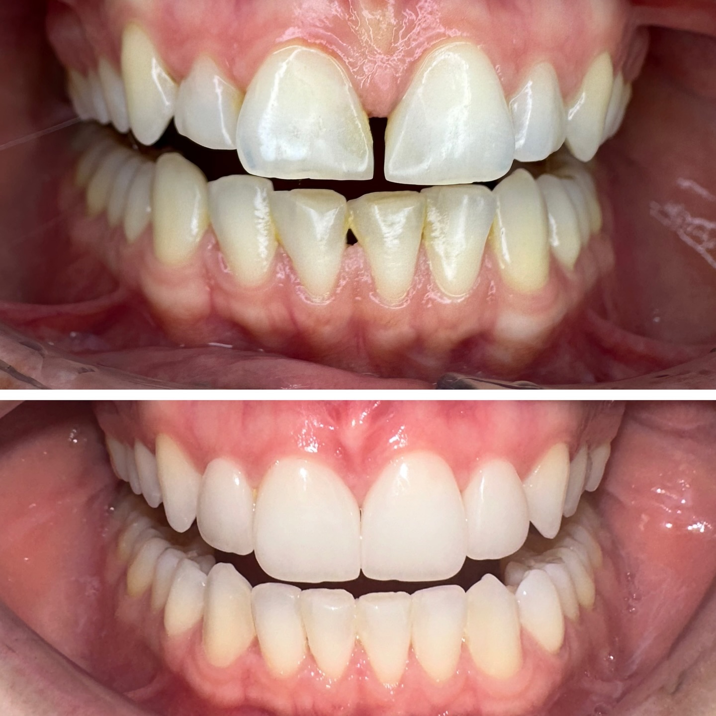 Dentista a Bari - Studio Dr.ssa Antonella Scorca Facebook ad: Allinea il tuo sorriso in pochi mesi con…