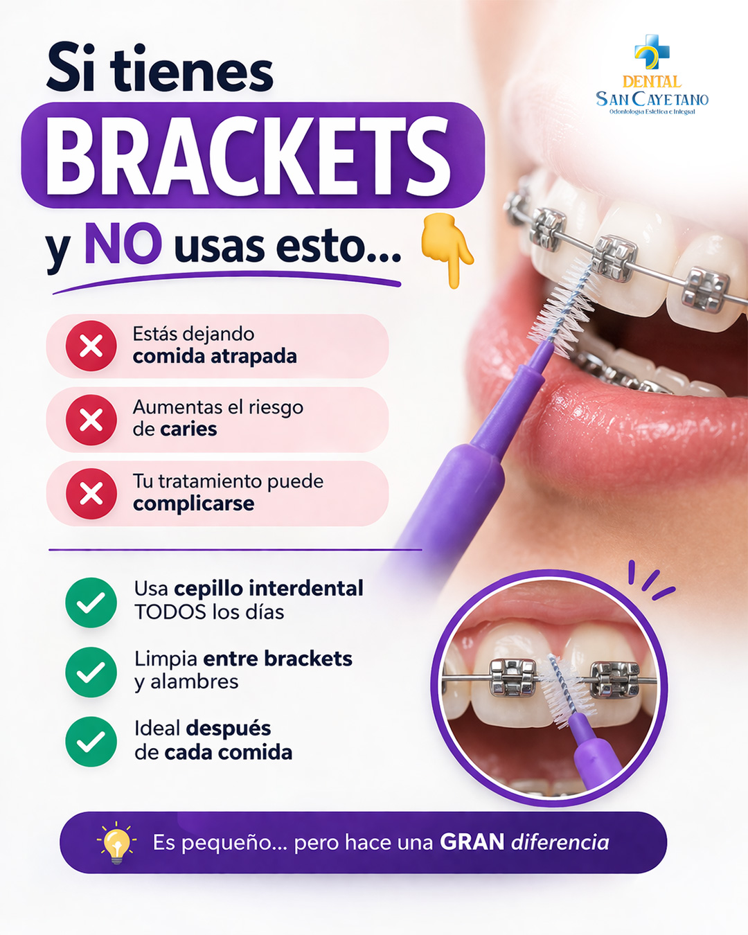 Dental San Cayetano Facebook ad: Tener brackets y no usar cepillo interdental…