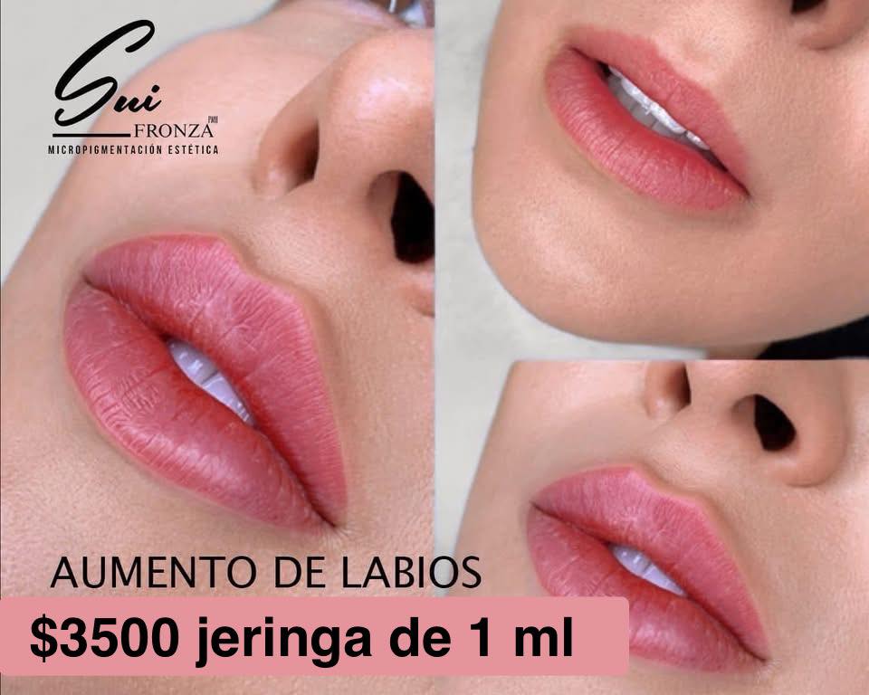 Sui Fronza Facebook ad: ¡Labios irresistibles en minutos!
