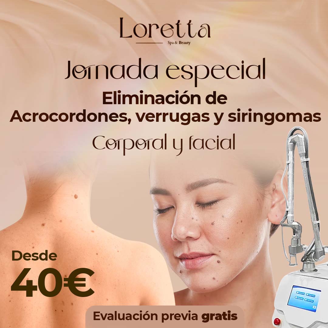 Loretta Spa Facebook ad: Chatea con nosotros