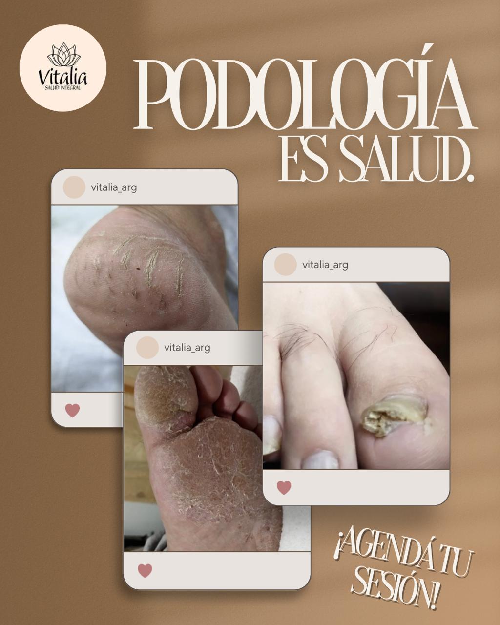 Vitalia Facebook ad: Podologia Vitalia