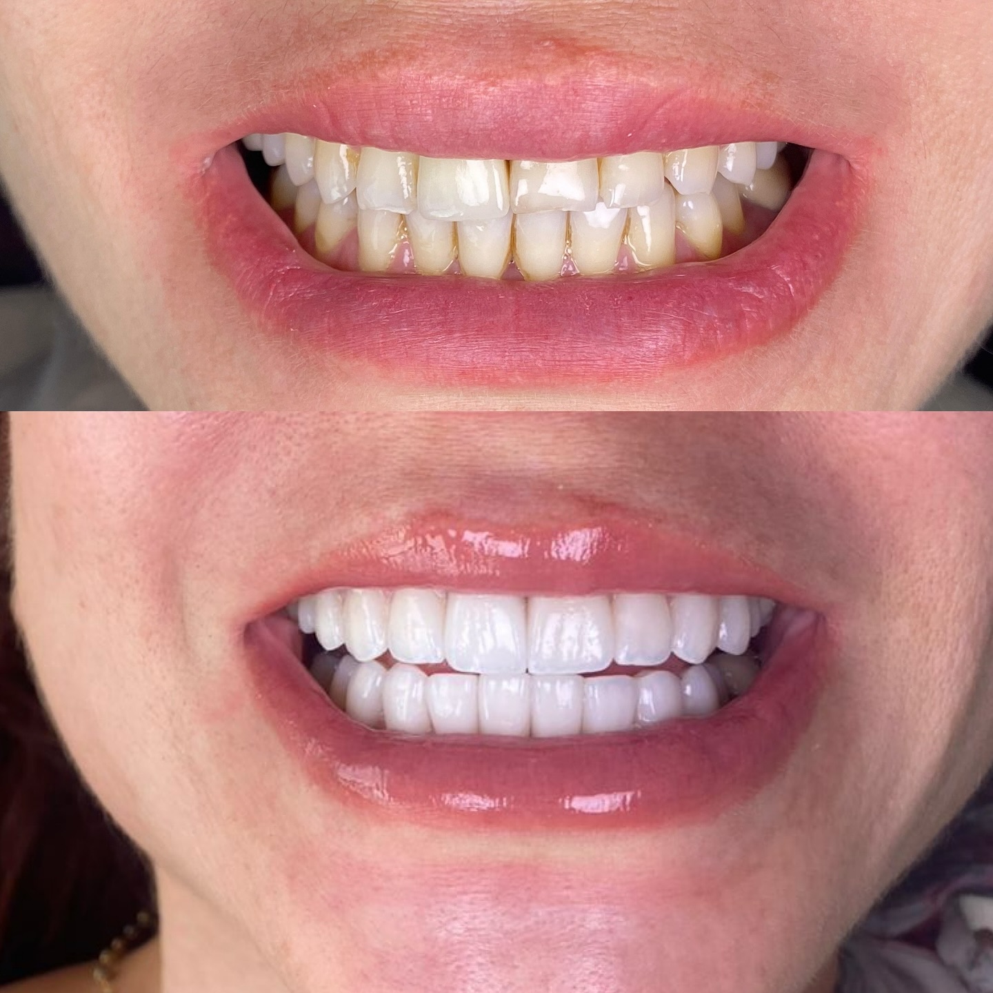Dr. Smile Colombia Facebook ad