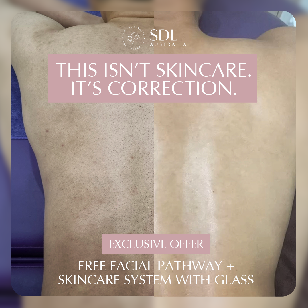 Sydney Dermal Lounge Revesby Facebook ad