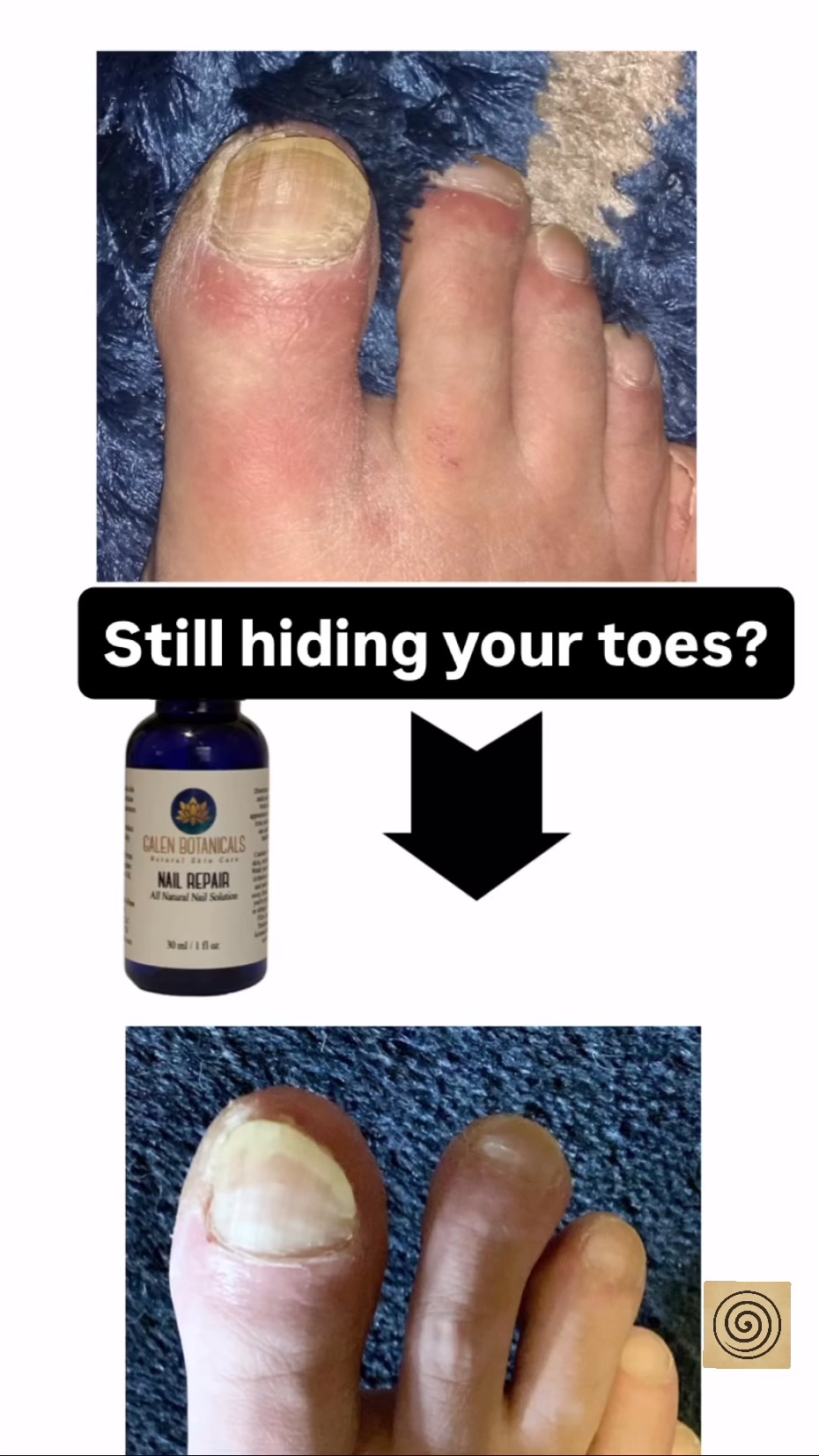 Dr Elaine Gavalas Facebook ad: Nail Repair, Available on Amazon