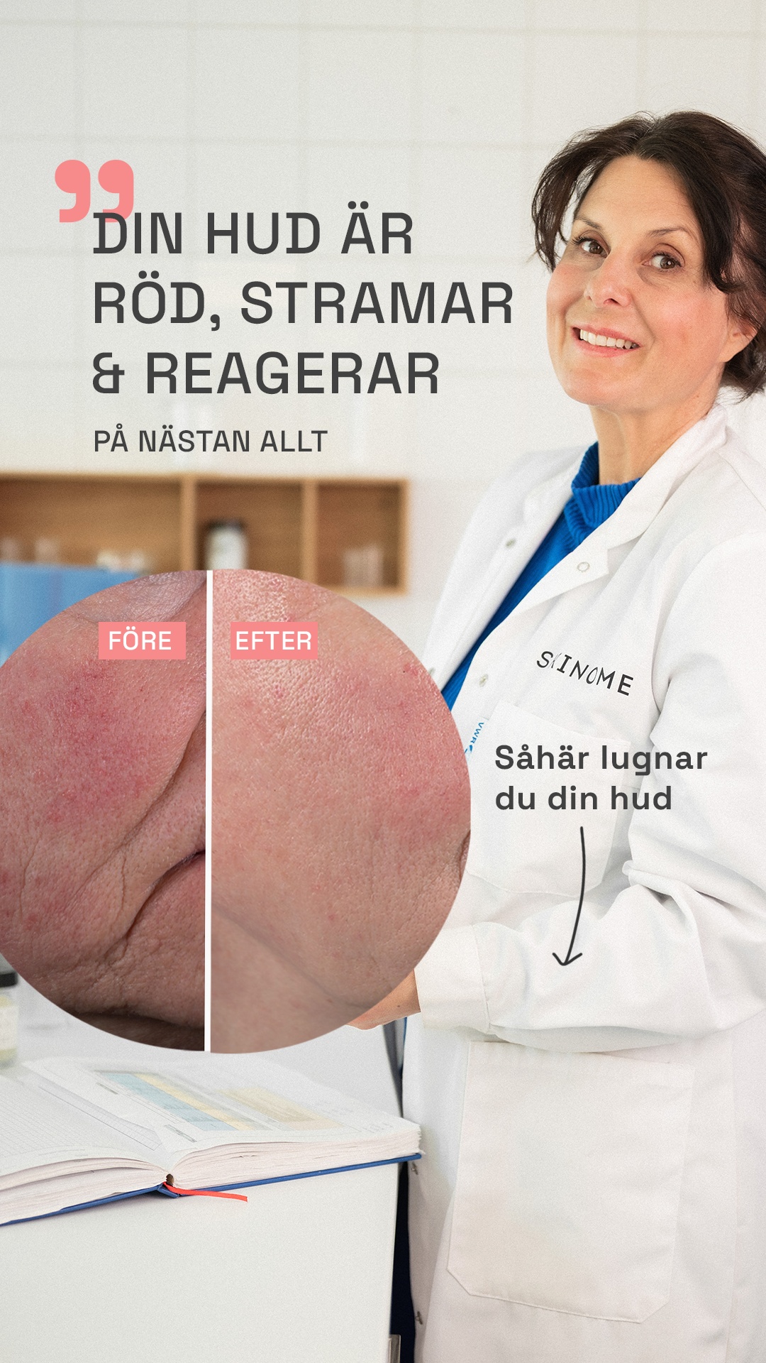 Skinome Facebook ad