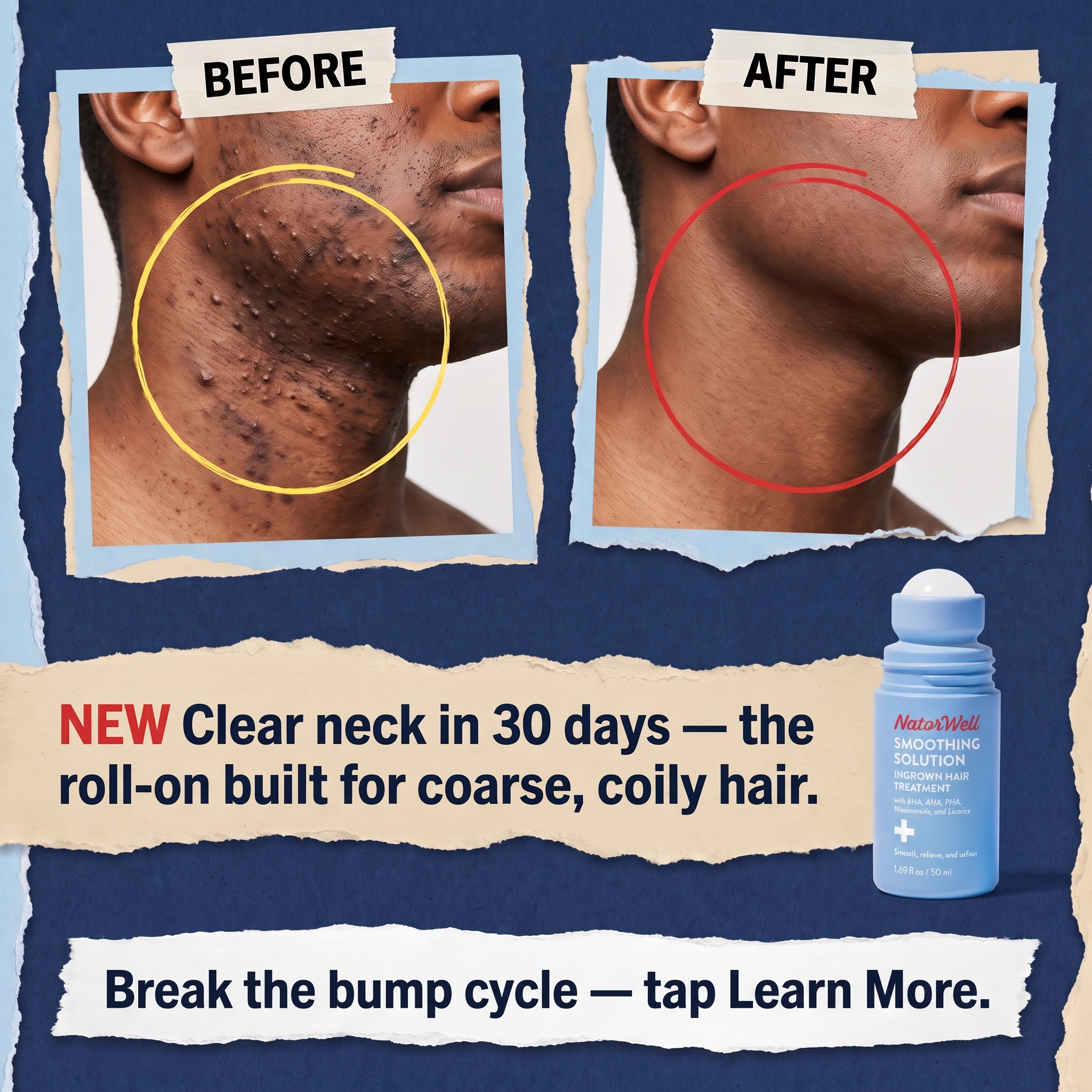 NatorWell Facebook ad: Try NatorWell Bump Relief & Soothing today and start…