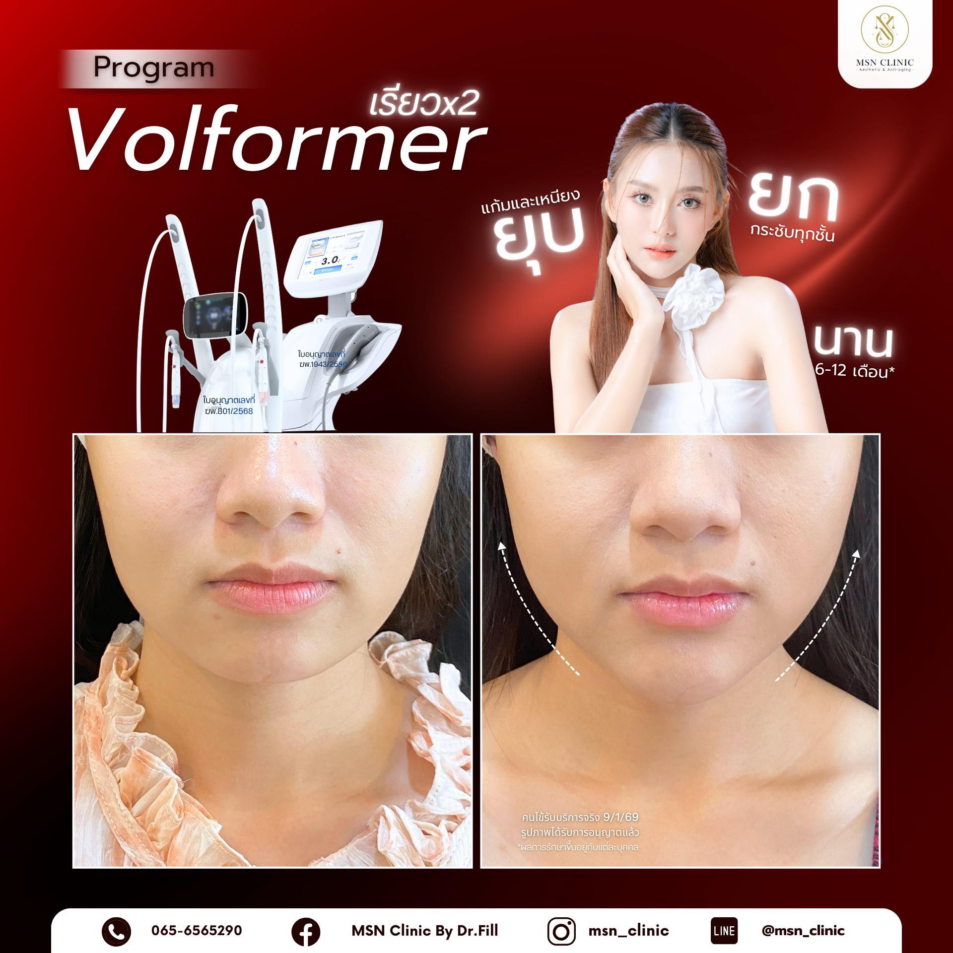MSN Clinic by Dr.Fill คลินิกเวชกรรมความงาม สุขภาพ และ ชะลอวัย สาขาระยอง Facebook ad