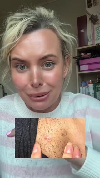Dr.Melaxin UK Facebook ad: [ TX Exfoliating & Tone-Smoothing Duo ]