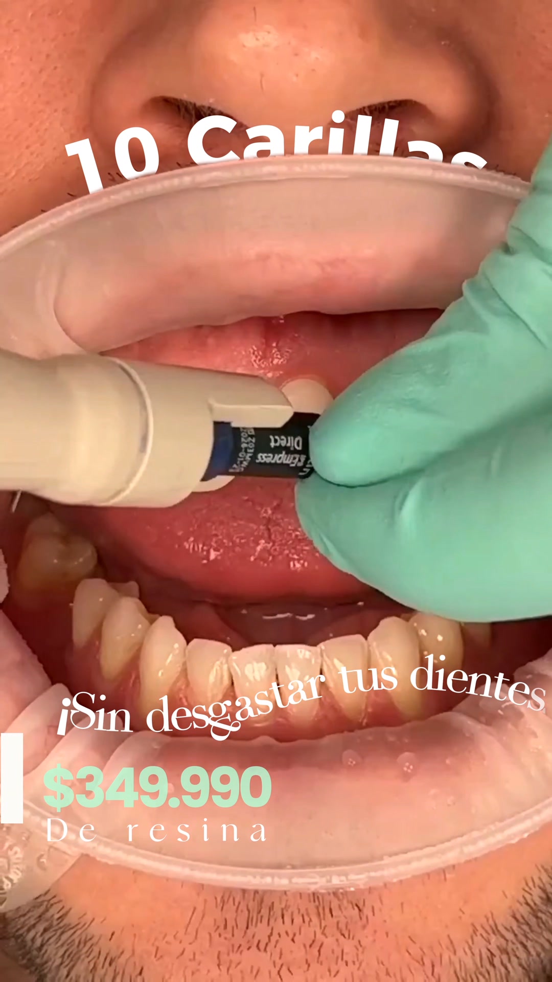 Salud Nacional Oficial- Centro Médico y Dental Facebook ad: ¡Sin desgastar tus dientes!