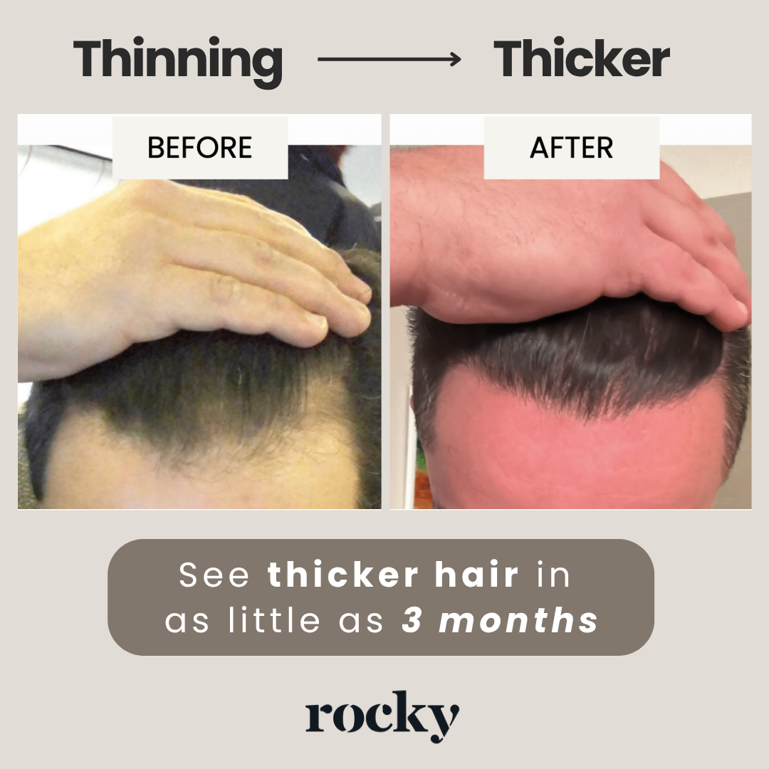 MyRocky Facebook ad