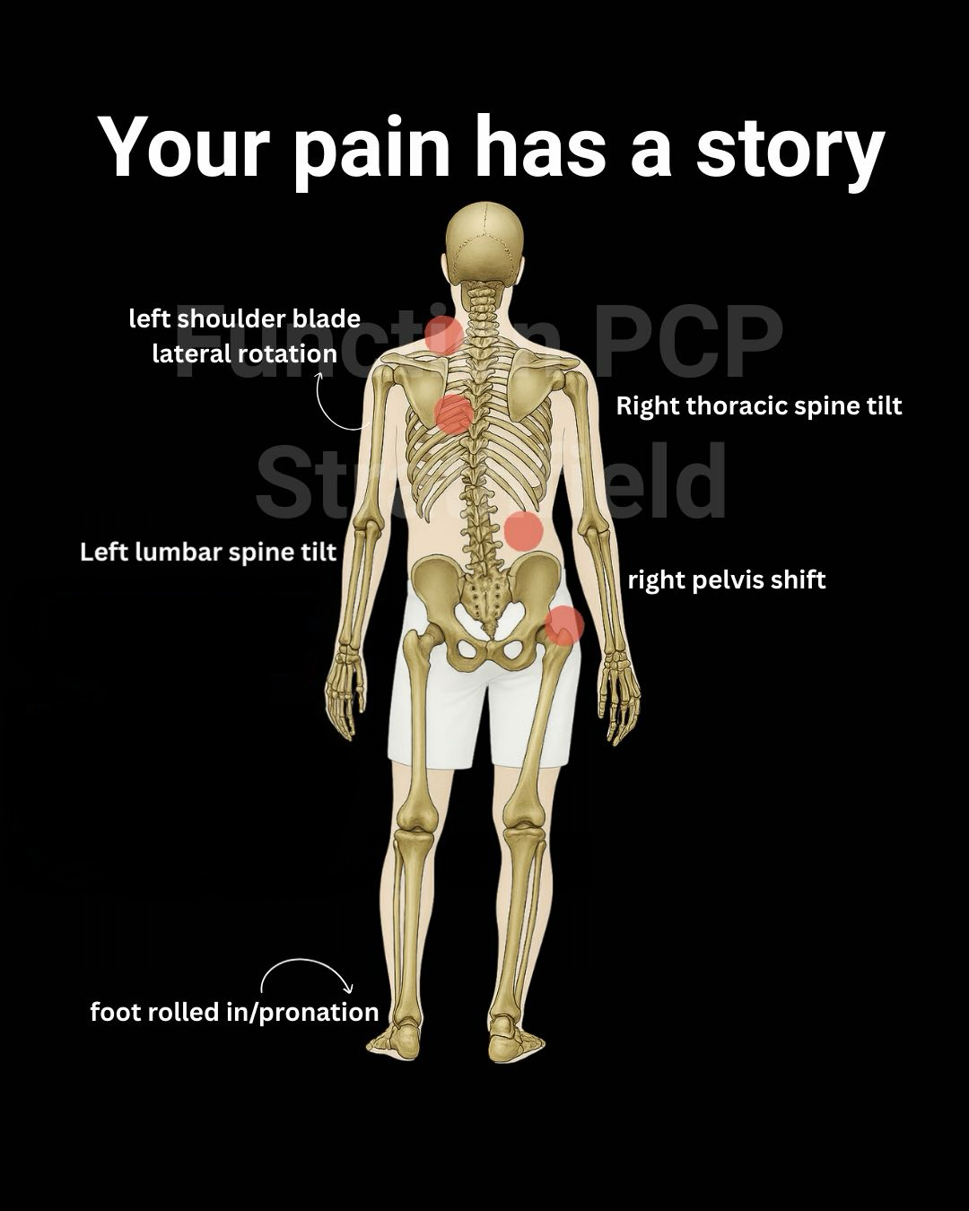 Function PCP Strathfield Facebook ad: Turn Aches and Tightness Into Strength and Control Through…