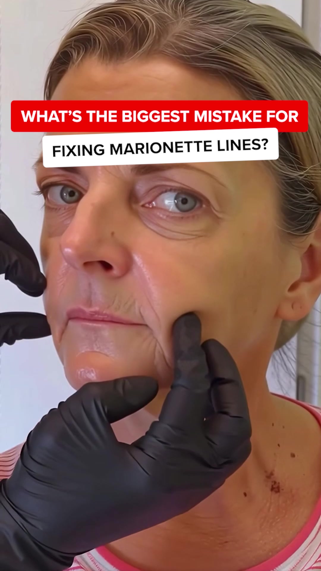Stephanie Edwards Facebook ad: Skin Expert: Stop wasting money on creams