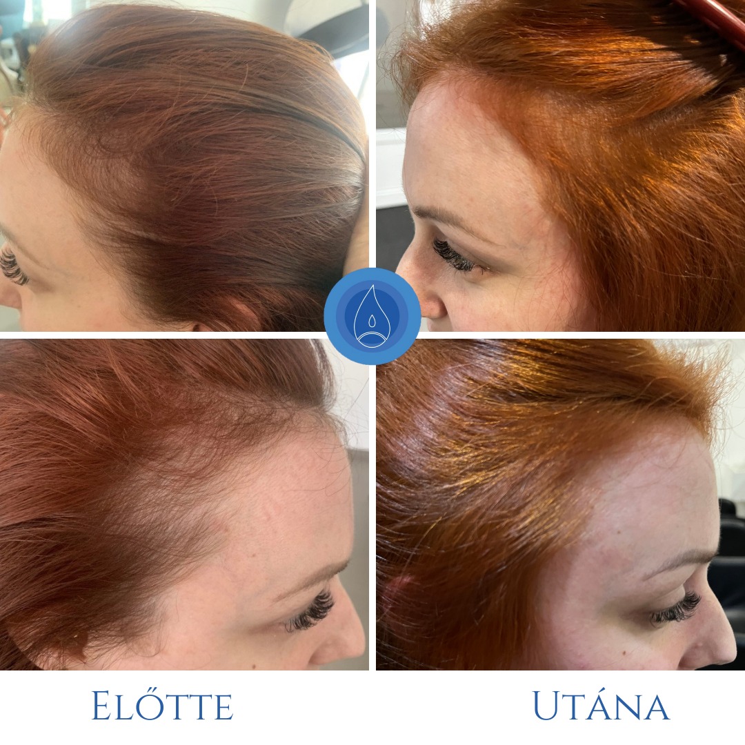 Oxygeni Hair & Skin  Hajgyógyász és Bőrterápia Szalon Mosonmagyaróvár Facebook ad