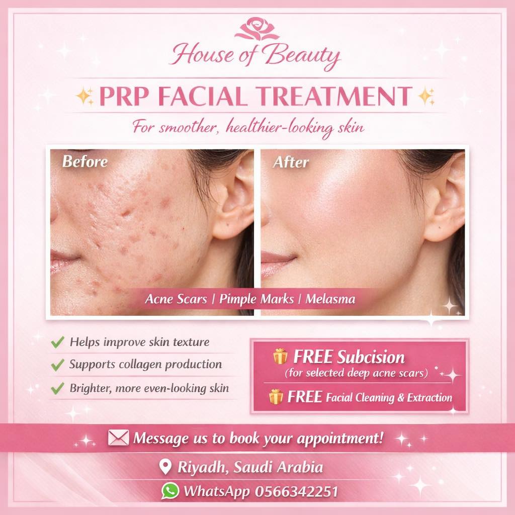 houseofbeautybymay Facebook ad: PRP FACIAL TREATMENT