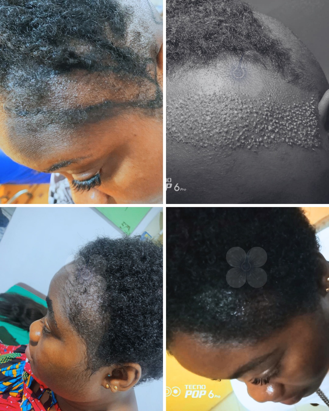 Hair Treatment Agency Rwanda Facebook ad