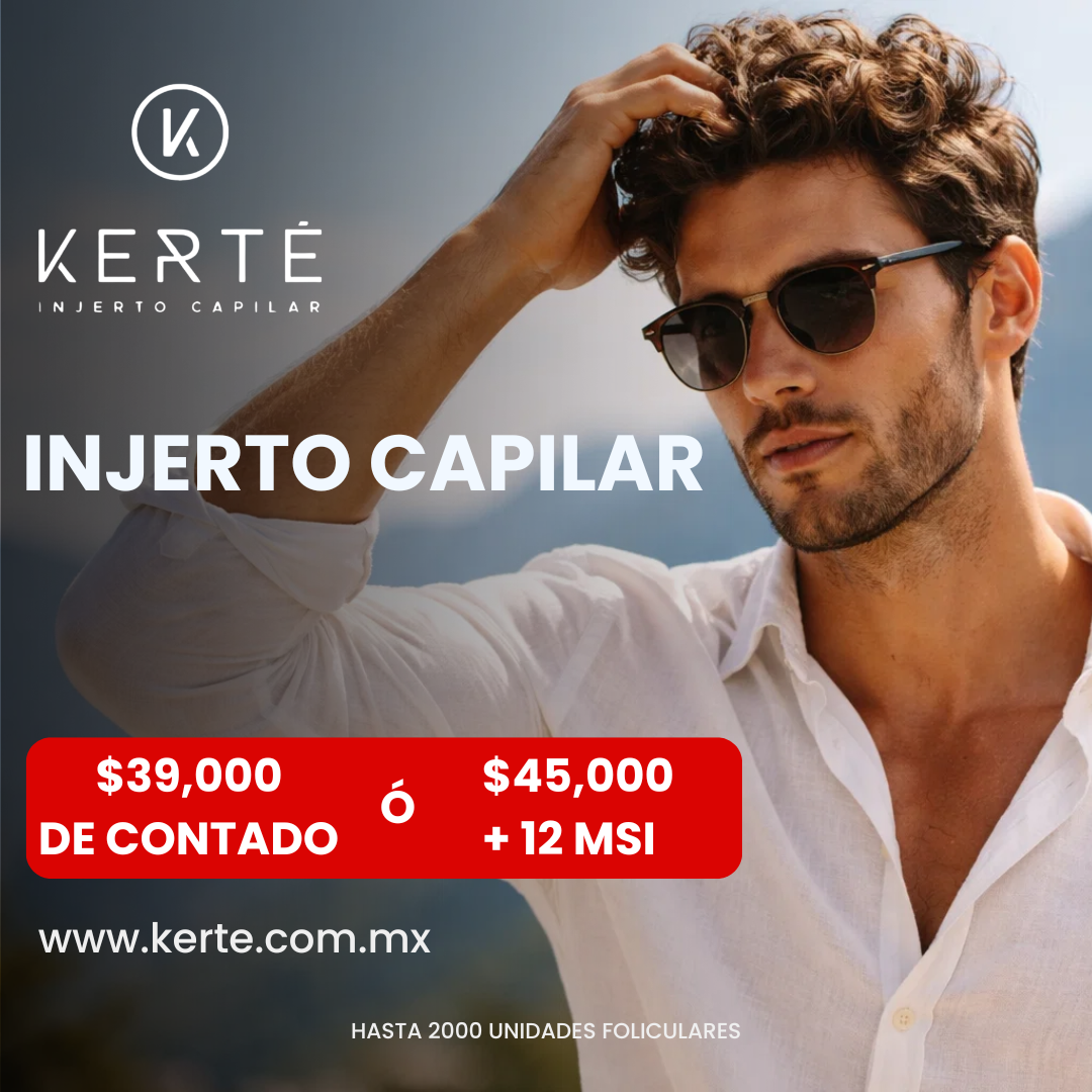 KERTÉ Facebook ad