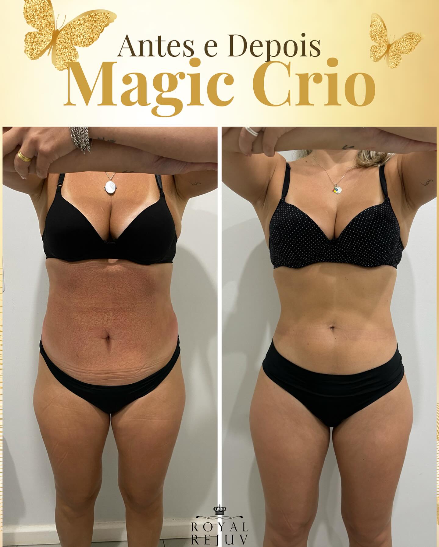 Royal Rejuv Clínica Estética Facebook ad: Por aqui, seguimos TRANSFORMANDO VIDAS