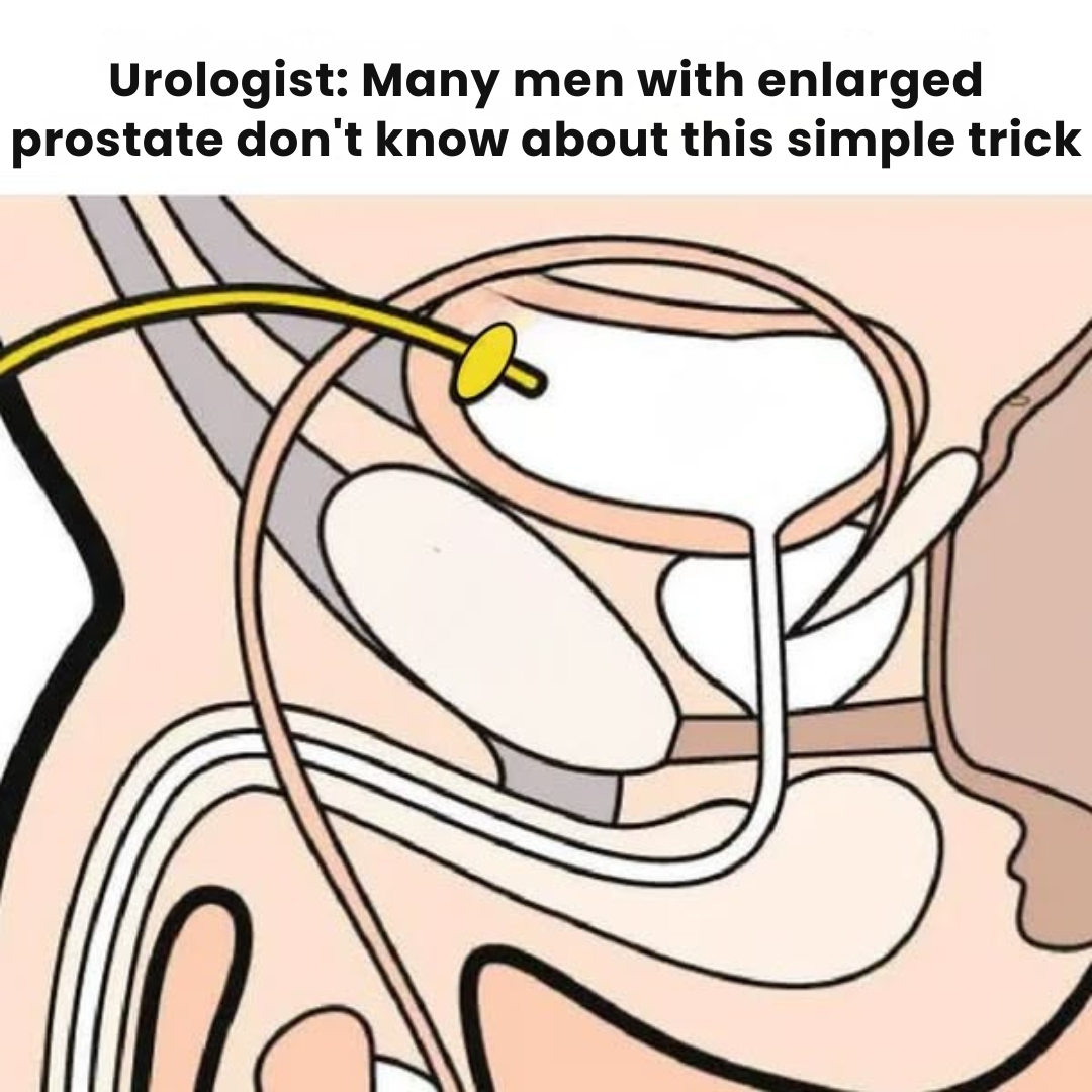 Urologist - Dr. Sarah Mitchell Facebook ad: Read This Before Taking a Prostate Prescription