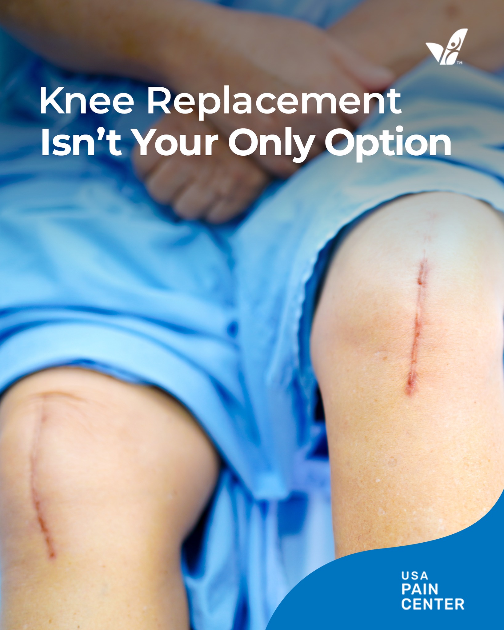 USA Pain Center Facebook ad: Learn about knee treatment without surgery!