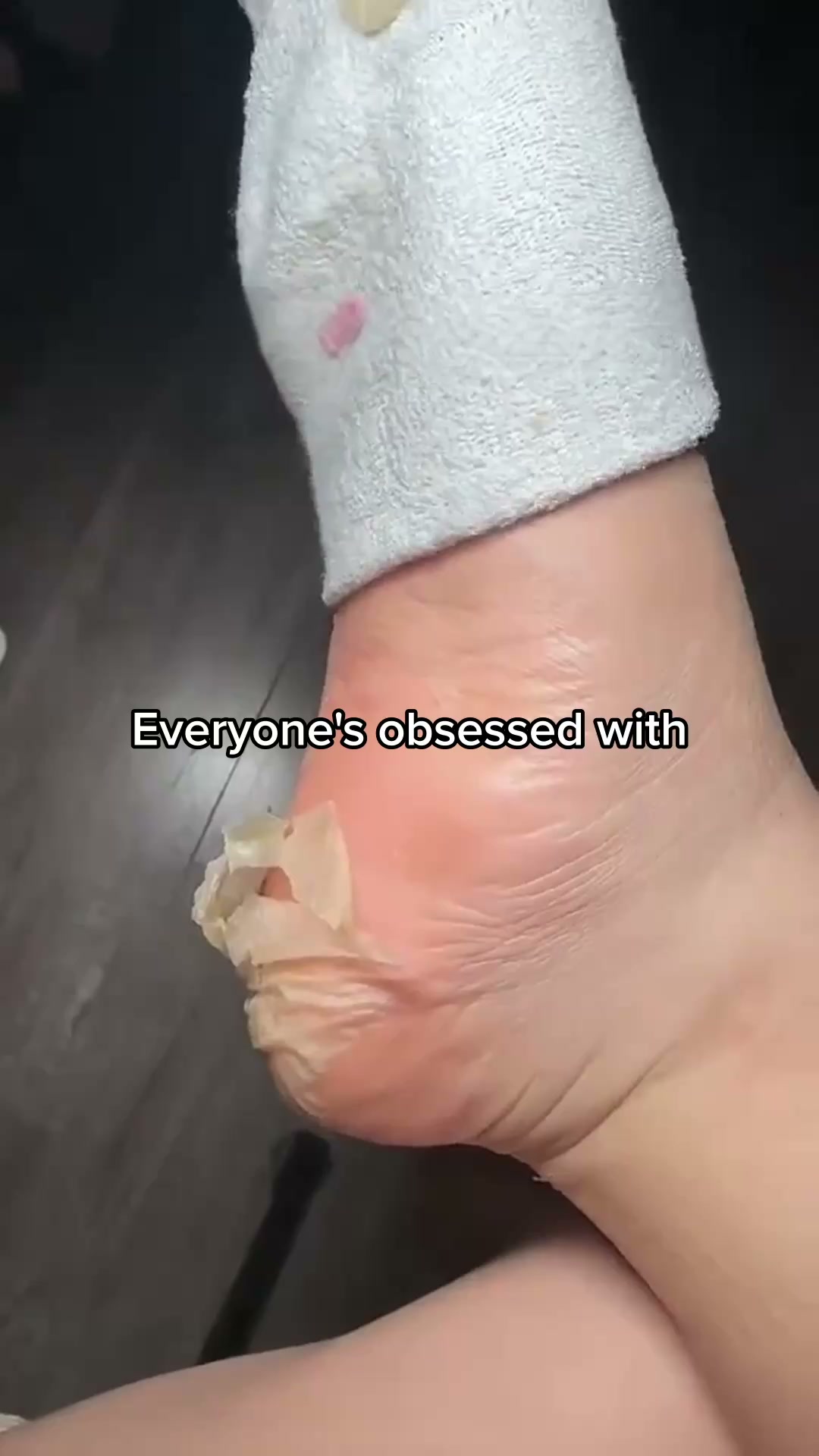 Nuvé Facebook ad: Baby soft feet in 5 minutes flat