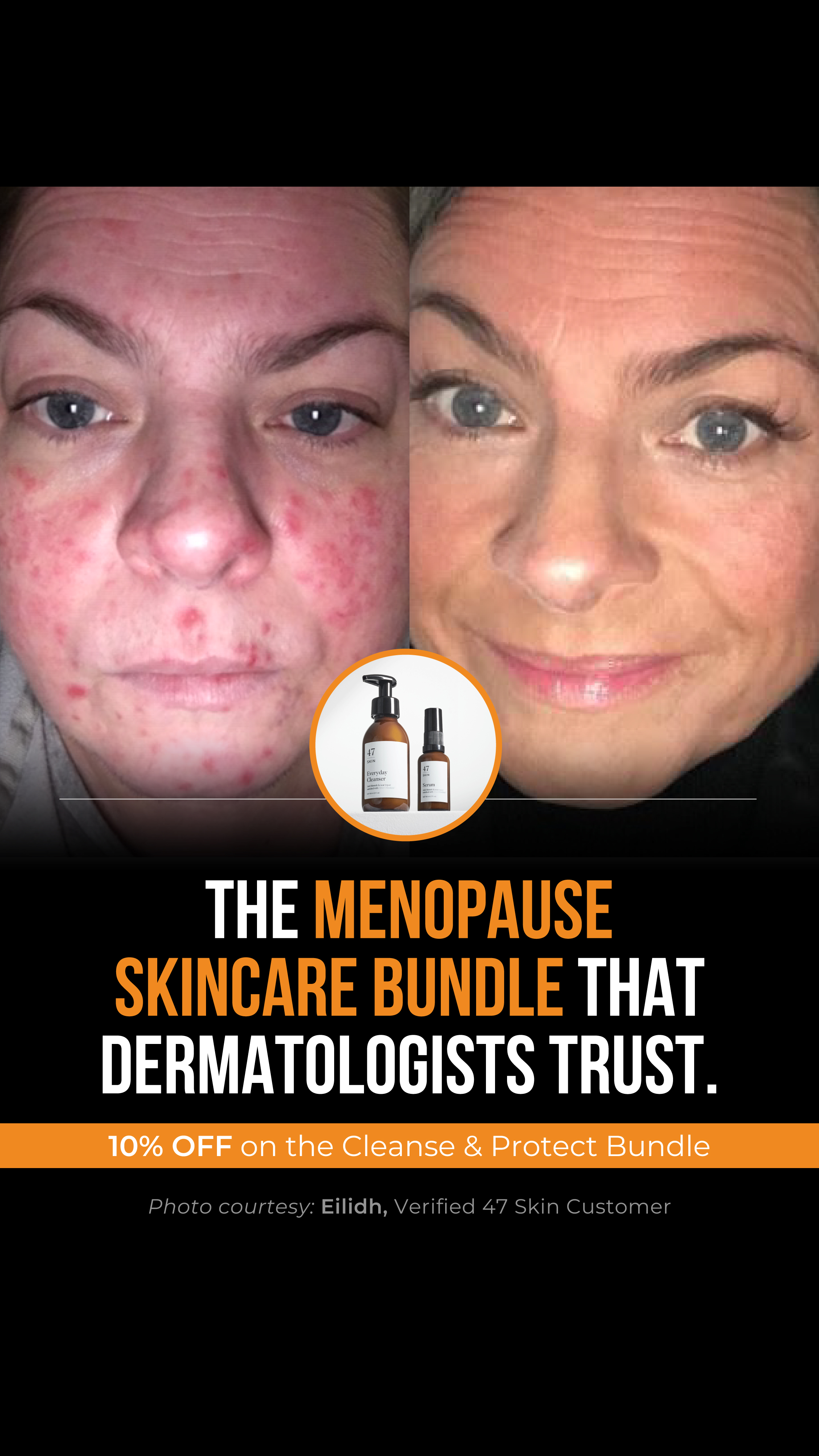 47Skin Facebook ad