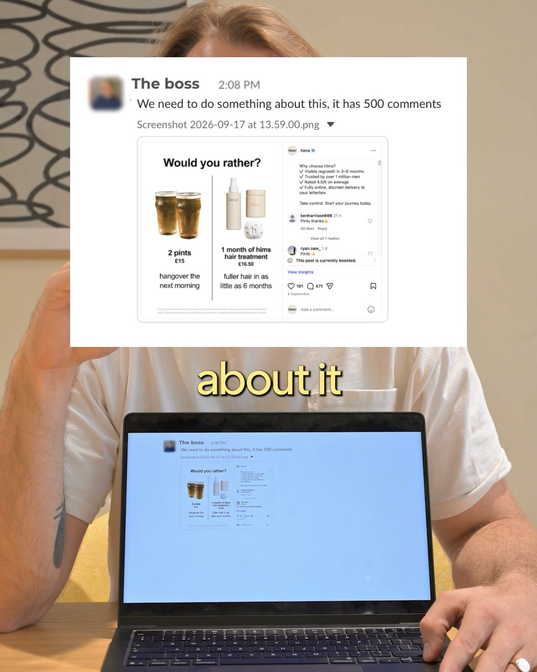 hims Facebook ad: Personalised Hair Regrowth Treatment