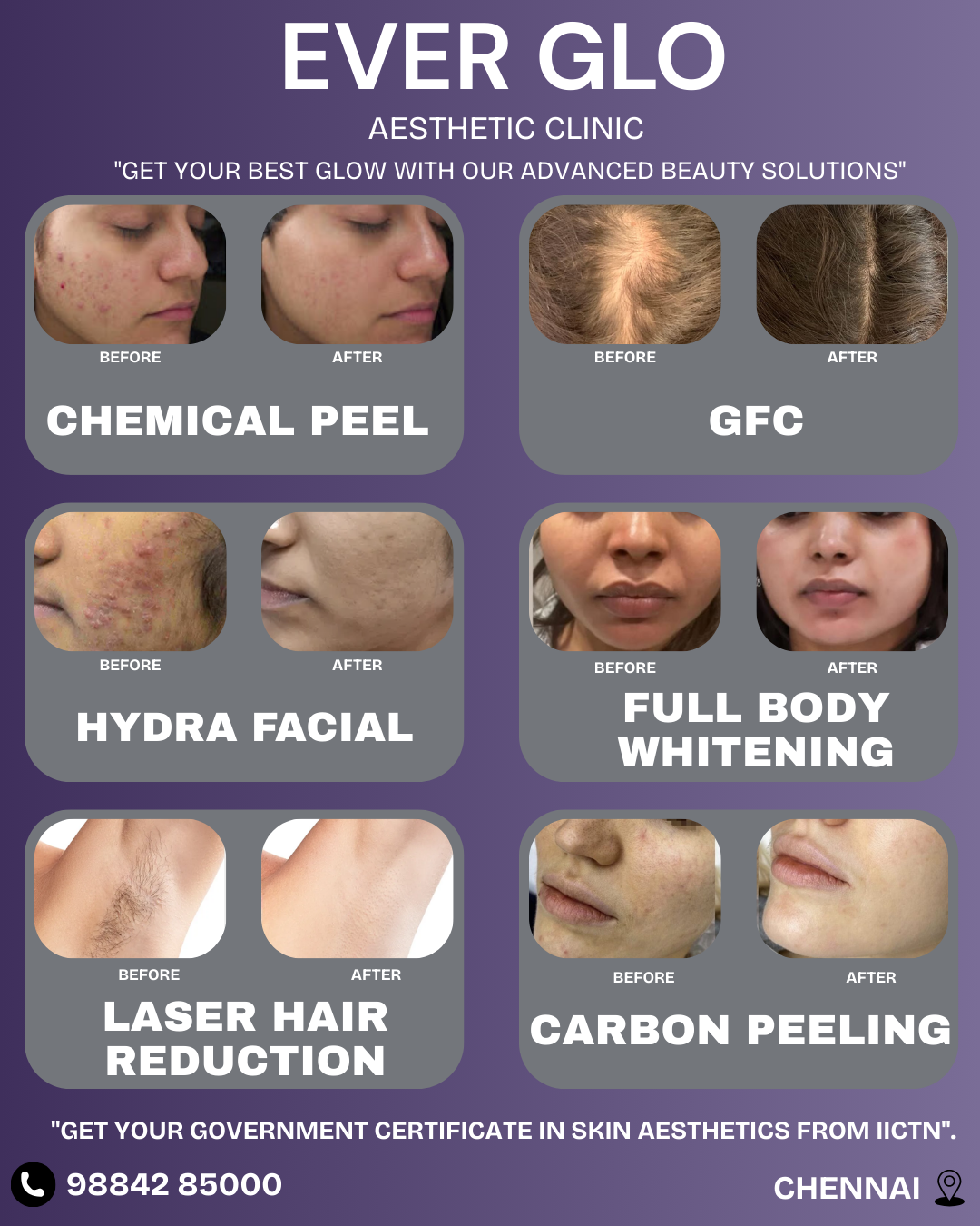 Everglo Aesthetic Clinic Facebook ad