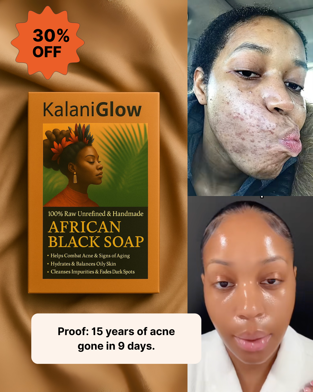 KalaniGlow Facebook ad
