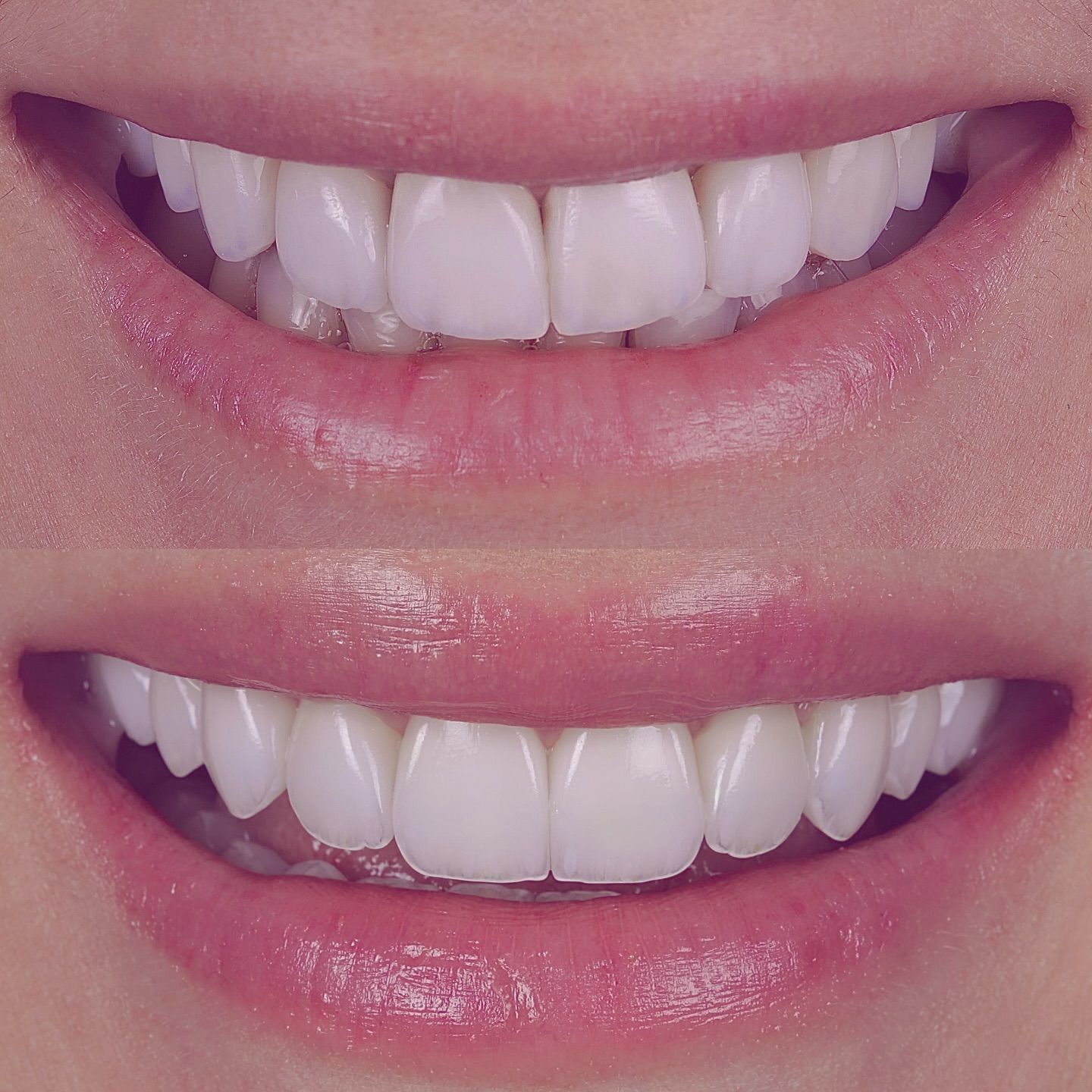 Rildo Lasmar Odontologia e Estética Facebook ad
