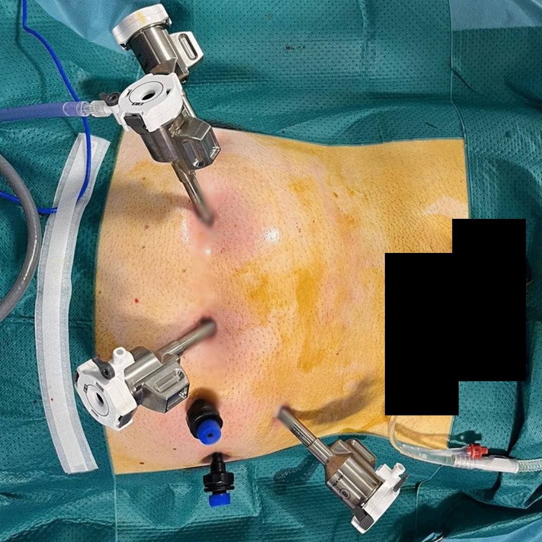 Eddy's Exhaustion Blog Facebook ad: What Your Urologist Hasn't Showed You