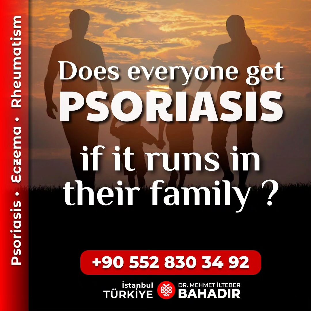 turkey_psoriasis_clinic Facebook ad: While the exact cause of psoriasis remains unclear…