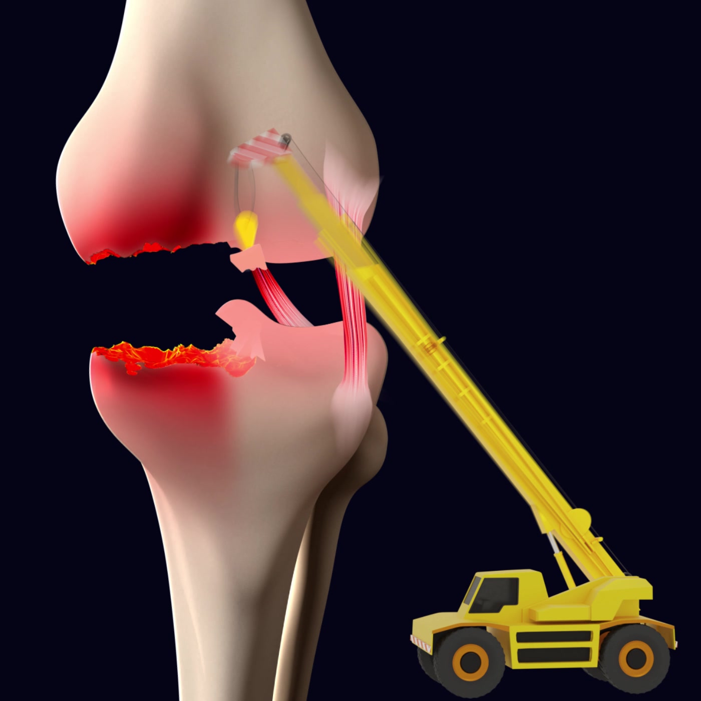 Collanol - colágeno no desnaturalizado + curcumina Facebook ad: Nuevo colágeno 3D elimina el dolor articular