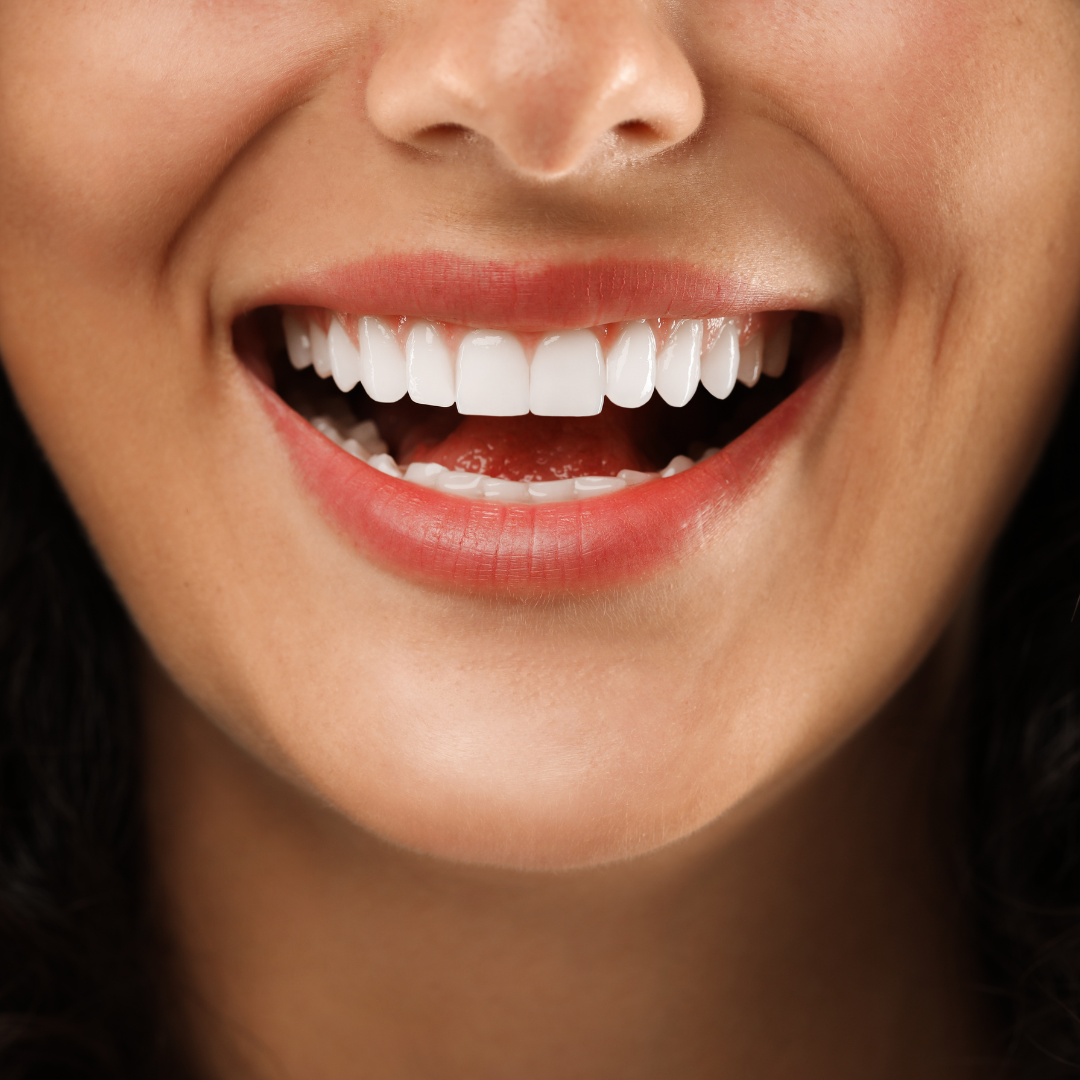 Stellar Dental Facebook ad: Restore your teeth with Stellar Dental’s crowns.