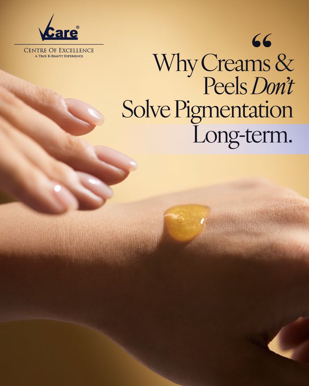 Vcare Centre of Excellence Facebook ad: Pigmentation needs depth-specific treatment not surface…