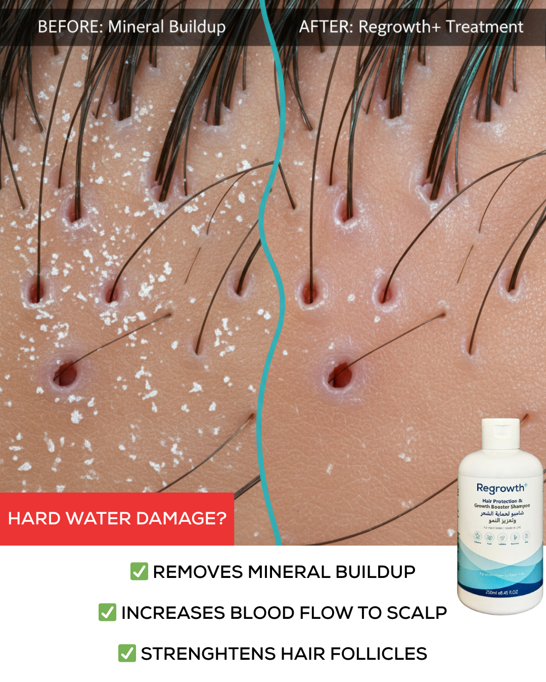 Regrowth+ Facebook ad