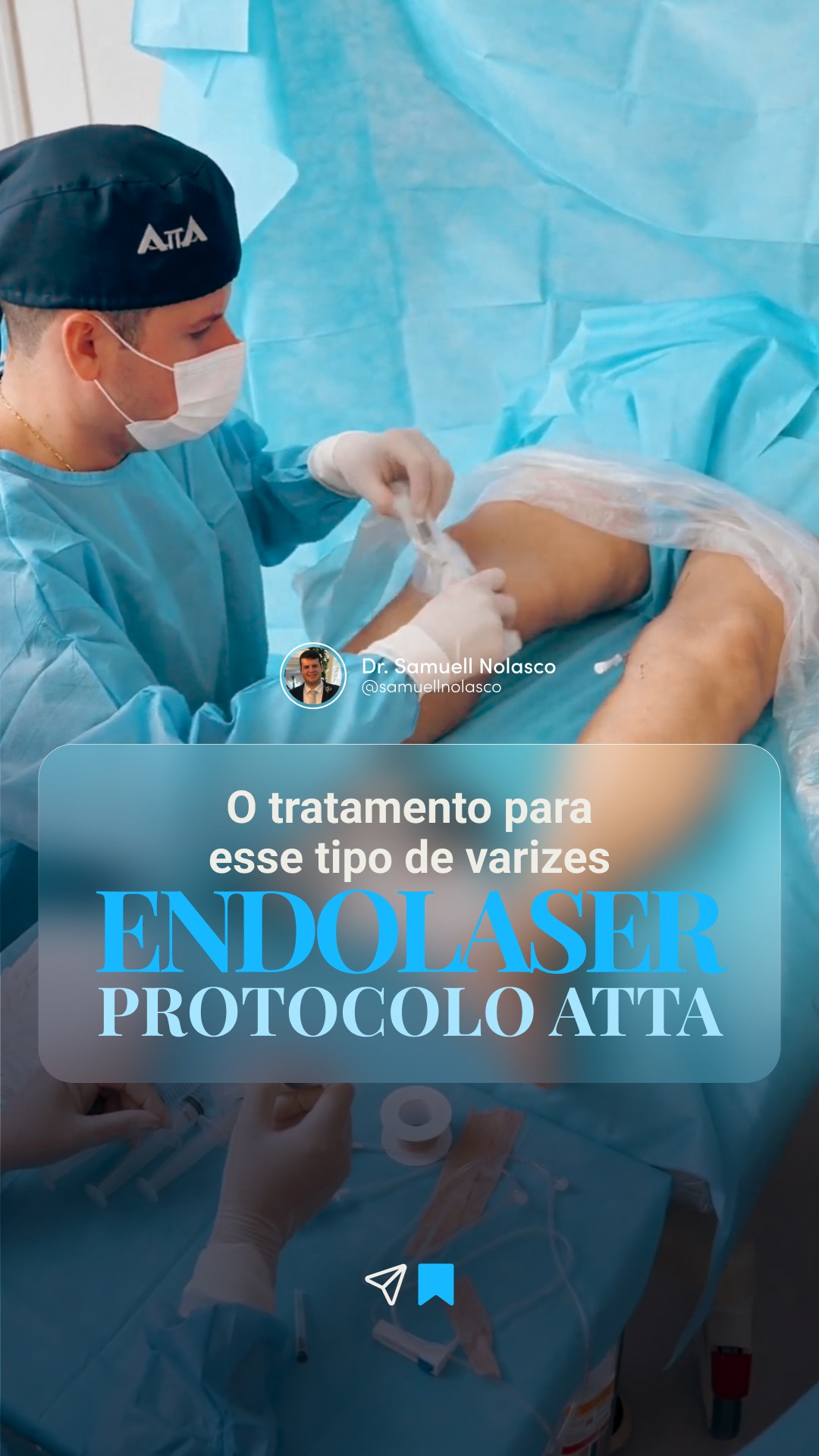 Dr Samuel Nolasco. Facebook ad: O Endolaser associado à técnica ATTA representa um…