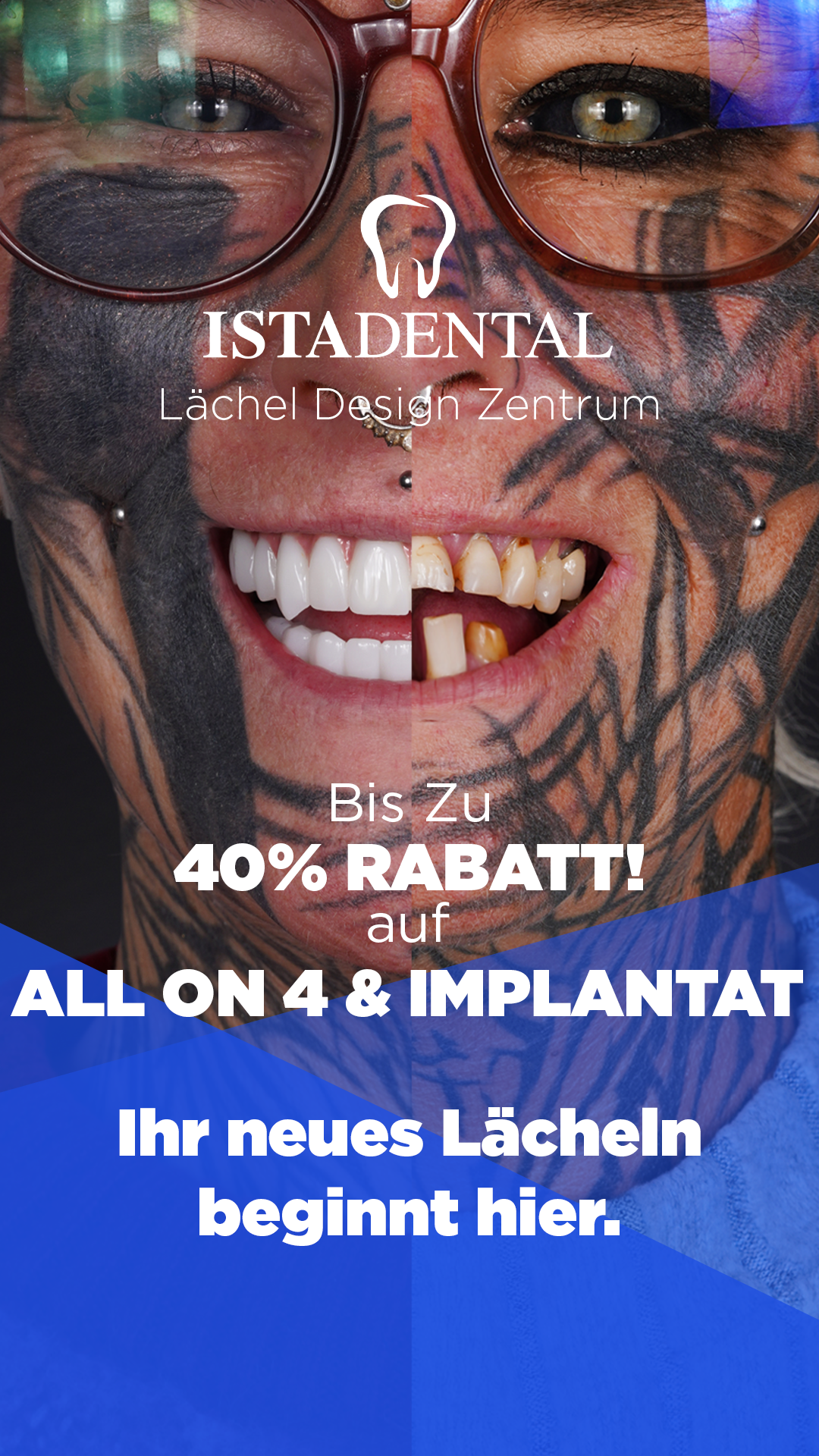İstadental Facebook ad: Neues Lächeln in wenigen Tagen