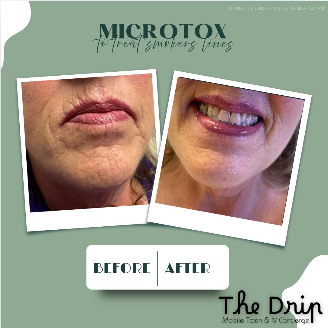 The Drip Mobile Toxin & IV Concierge Facebook ad: Your one stop shop for IV Hydration, Tox…