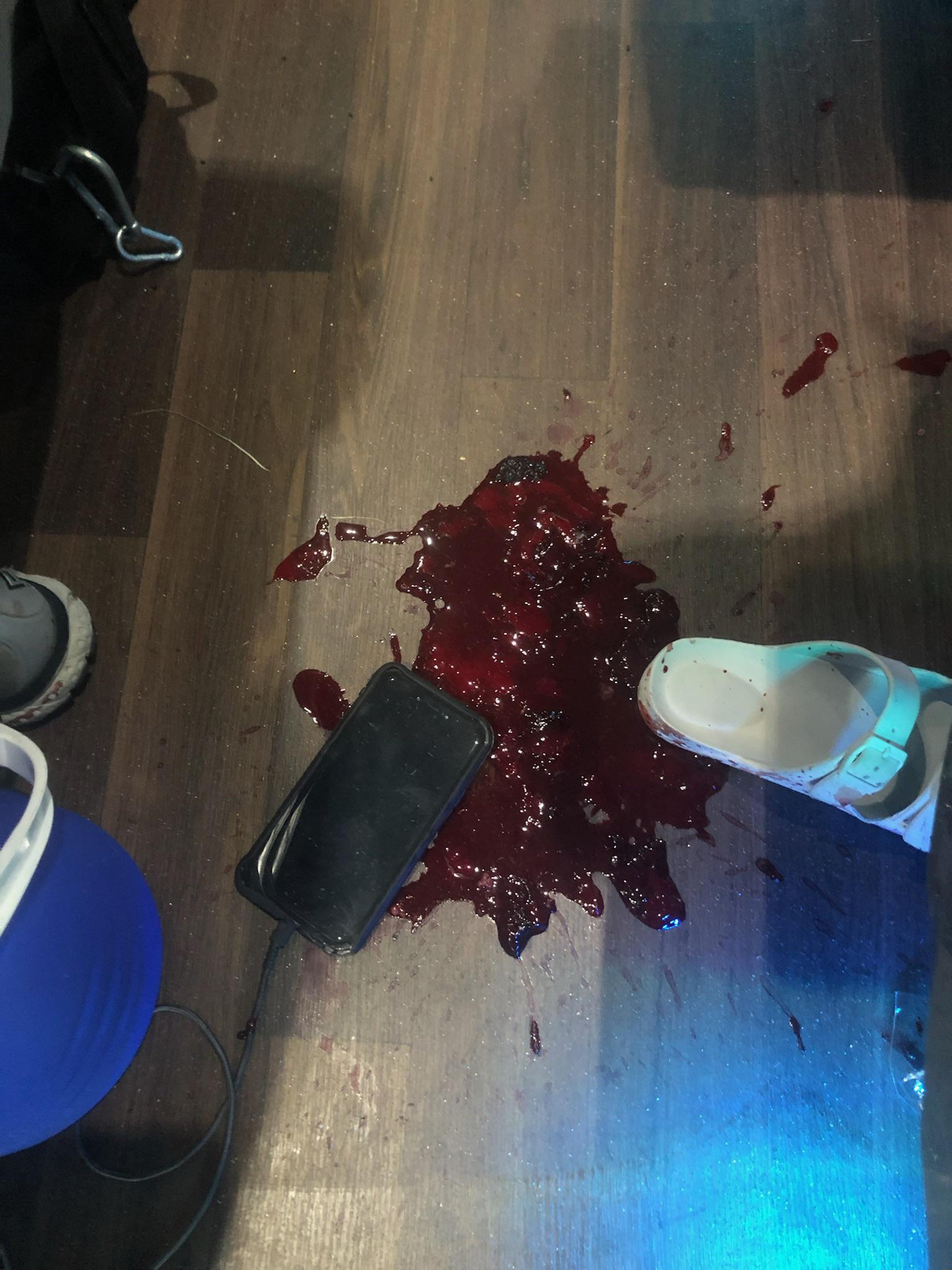 David Andrews Facebook ad: I Collapsed Vomiting Blood After 4 Beers